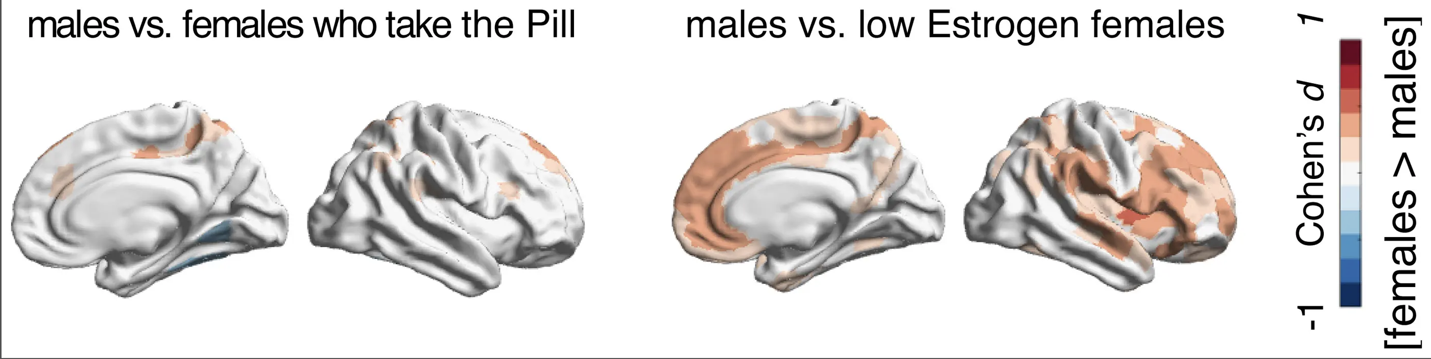 Sex hormones and brain microstructure
